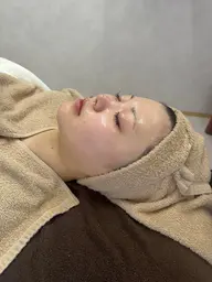 【 🎀オープン限定特別価格🎀 】ラレステン艶肌ピーリング 90分 ¥6,500