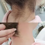 今の時期大人気💥うなじWAX👸