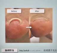 【foot】Hey Switchジェル巻き爪ケア