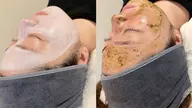 フェイシャルモニター様募集中！ビフォーアフターお写真OKな方◎3種類からお悩みに添ってメニュー決めれます！