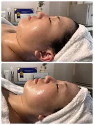 【オープン記念人気No.1】むくみ・フェイスラインすっきり✨️肩首・ヘッドマッサージ付き 小顔コルギ60分