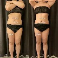 冷却ダイエット【筋膜リリース、引き締め美容液付き❗️】痩身❄️痩せたい部位の脂肪を集中アプローチ!1部位(2カップ)