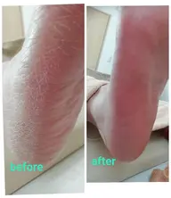 角質+爪ケア60分