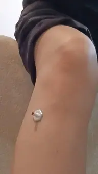女性のお悩み鍼灸
