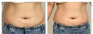 【3名様限定】体の疲労、浮腫にさよなら👋 60分  通常11,000円→初回3,980円