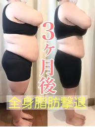 【人気No.1】⭕️1回で結果を出す全身脂肪撃退マッサージ90分🔥ラジオ波＋吸引×リンパマッサージ