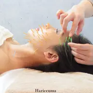 🫧【25歳以下限定】はじめての美容鍼
