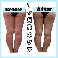 【通い放題】1ヶ月集中ケア☀️キャビテーション/痩身/フェイシャル60分コース回数制限なし🙅♀️ 人数限定⚠️