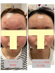 各務原市在住の方限定❤️1,100円分のオプションパック付アドバンスコース