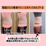 【写真モニター募集】電磁パルス痩身マシン《ボディスカルプト》4回（週一）