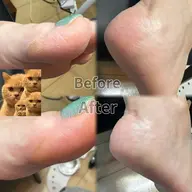👣専用マシンでフットケア🫧［フットバス＋スクラブ＋甘皮処理＋お爪の形成＋足裏角質ケア＋保湿］※オフ・ジェル塗布無し