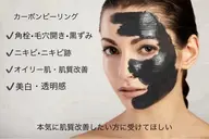 毛穴の黒ずみが気になる人はカーボンフェイシャル(男性女性可)、一回の施術で驚きの効果、メンズもOK