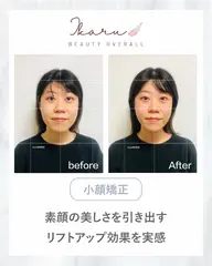 【期間限定モニター】小顔かっさ 20分|フェイスラインをすっきりケア