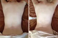 【ミニモ限定クーポン】微弱電流を使って肩、背中のメンテナンス🌴肩こりや下着から漏れる気になるハミ肉へアプローチ
