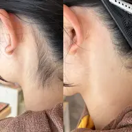 【水・木・金・土日】【女性限定✨】お顔剃り＋うなじシェービング