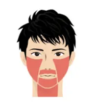 【脱毛期間限定！】3回まで同価格♪メンズヒゲ脱毛 1回　※2回目以降はお尋ね下さいませ。