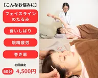 美容鍼を試したい貴女に 速攻小顔コース(指圧マッサージ+美容鍼)