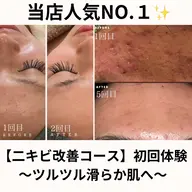 【本気集中】年齢毛穴ケア(剥離あり)通常18,000円