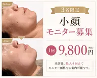 【3名限定】たるみ・二重あごに｜小顔フルコース症例モニター