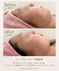 【メニューにお悩みの方はこちら♪】お悩みに合わせて最適な施術をご案内◎