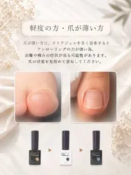 Hey Switch 巻き爪ケア（軽度）