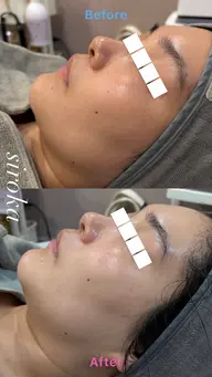 【毛穴・くすみ改善✨】艶肌フェイシャル