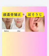 頭蓋骨矯正➕耳掃除