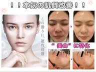 〈毛穴・シミ・くすみケアに〉韓国肌🩷白玉乳酸ピーリング