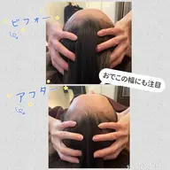 ヘッドマッサージ30分