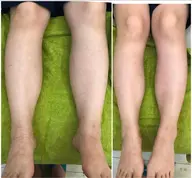 ［美脚・浮腫み解消］重く疲れたふくらはぎの硬く疲れた足のリンパを流す
