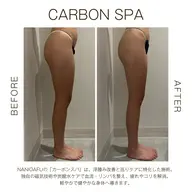 【🌿巡り×むくみ集中ケア】CARBON SPA(上半身or下半身選択)|温活×深部リリース〈都度払いOK〉