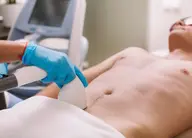 メンズVIO脱毛