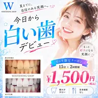 \6/15まで☆/【🌻６月クーポン📣】 Wホワイトニング15分×2回照射　通常¥5,980→¥1,500
