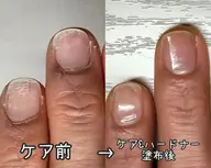 自爪育成ハンドケア【ファイリング+甘皮処理(ウォーターケア)+ハードナー塗布】