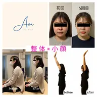 【身体と顔のトータルメンテナンス】肩こり鍼灸×美容鍼 90分 ¥17900→¥9800