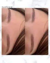 ブロウリフト