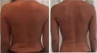 【露出準備OK？】隠してる二の腕背中60分｜痩身エステ