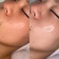 水光生美容液🫧