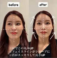 【平日限定】骨格矯正ヘッドスパ90分(歪み解消)