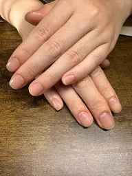 ケアのみ