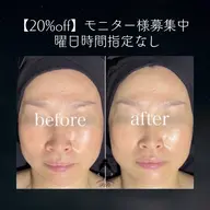 集まり次第終了 |モニター様募集| 20%off |時間曜日指定なし🌙小顔リンパマッサージ
