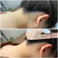 【女性】うなじワックス+光脱毛