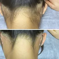 👱♀️女性【撮影モニター】うなじWax/SNS等に掲載可能な方