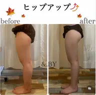 “すぐ痩せたい”を叶える、即効ケア⭐3種マシーンから選べる‼️とにかく痩せたい方へ💖《太もも・ふくらはぎ》 ¥3300