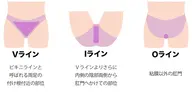 ミニモ学割(中学生まで)V.I.O 1回