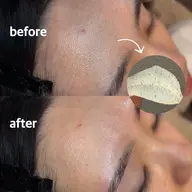 【ツルツルなお肌に✨️】フェイシャルワックス(全顔)