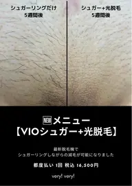大人気！VIOシュガー＋エステ脱毛：両ワキエステ脱毛付き【女性限定】