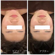 【リスタートキャンペーン】全身ケア＋毛穴洗浄
