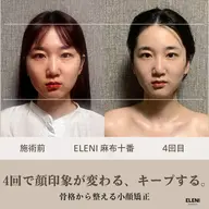 ✨おすすめ✨小顔×姿勢×全身ケア|トータル美容整体150分🍀口コミで10分延長🎁麻布十番プライベートサロン