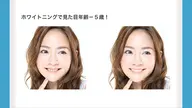 セルフホワトニング